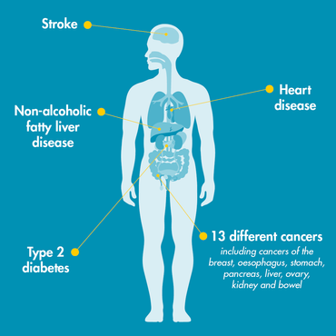 Obesity and health